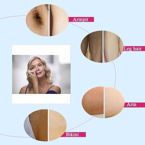 Image of Flawless Hair Remover