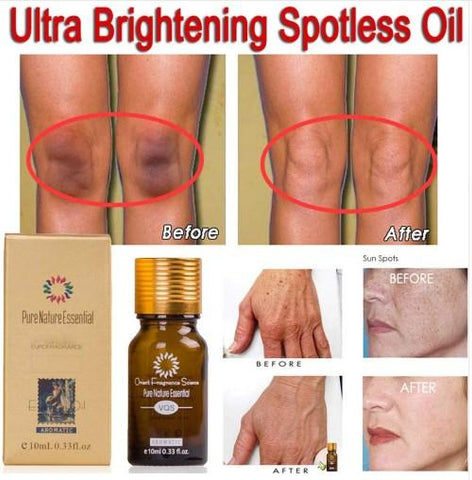 Image of Pure Natural Essential Ultra Brightening Spotless Oil Dark Spots Fade Away Age Spots Hyper Pigmentation Essential Oil.